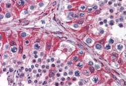 PACE4/PCSK6 Antibody, Novus Biologicals 0.1mg; Unlabeled:Antibodies, Polyclonal